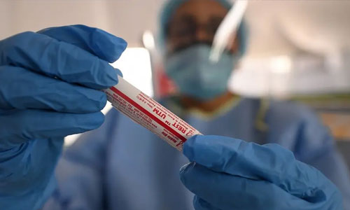 شمار افراد مبتلا به ویروس کرونا در کشور به ۳۰ هزار و ۴۵۱ نفر رسید